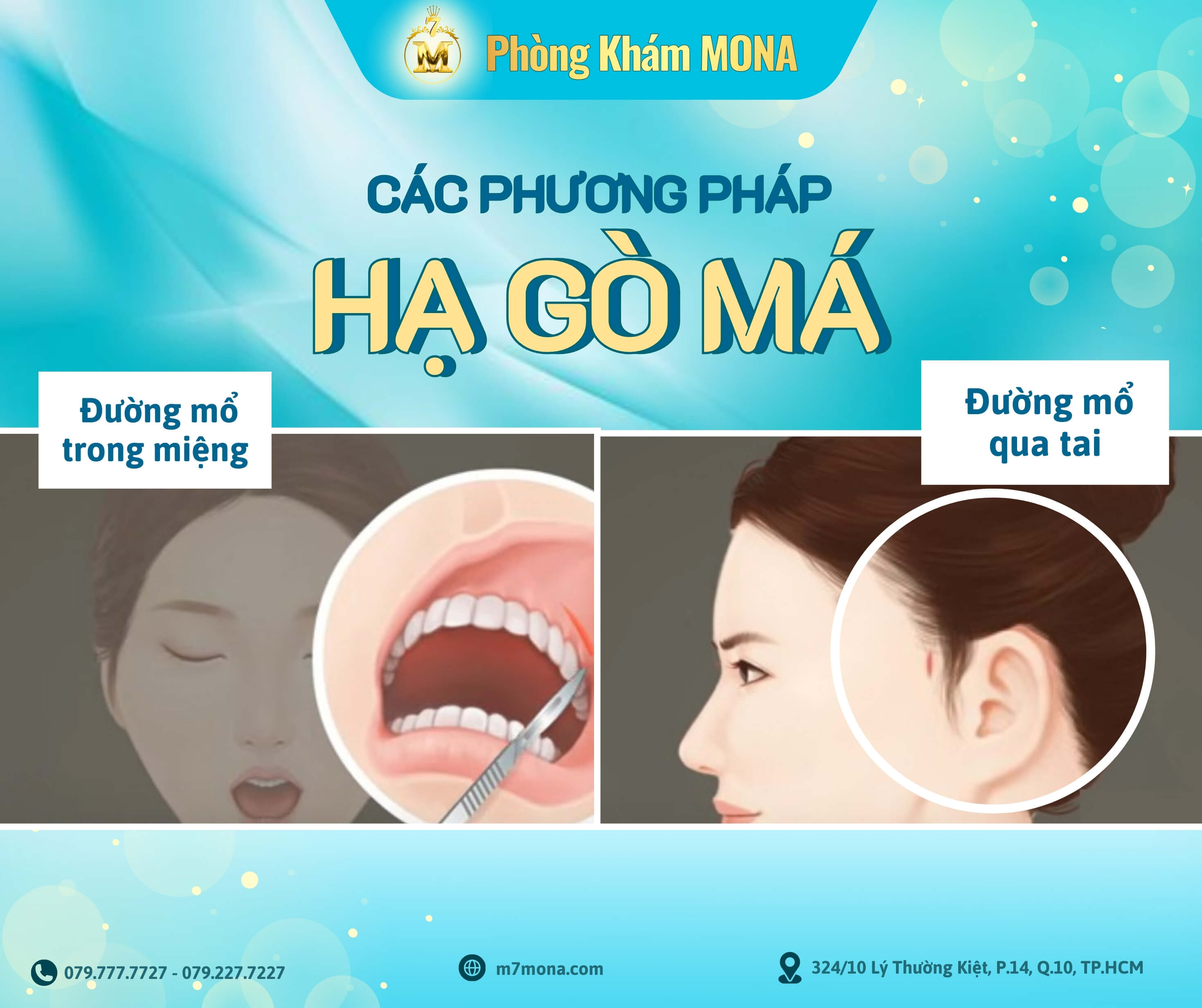 Cac phuong phap ha go ma