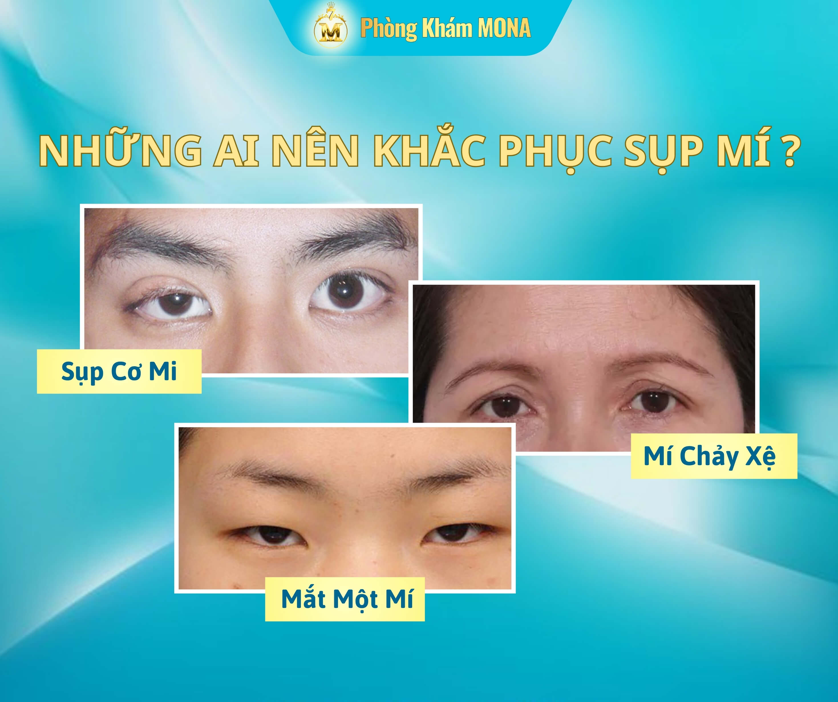 Nhung ai nen khac phuc sup mi