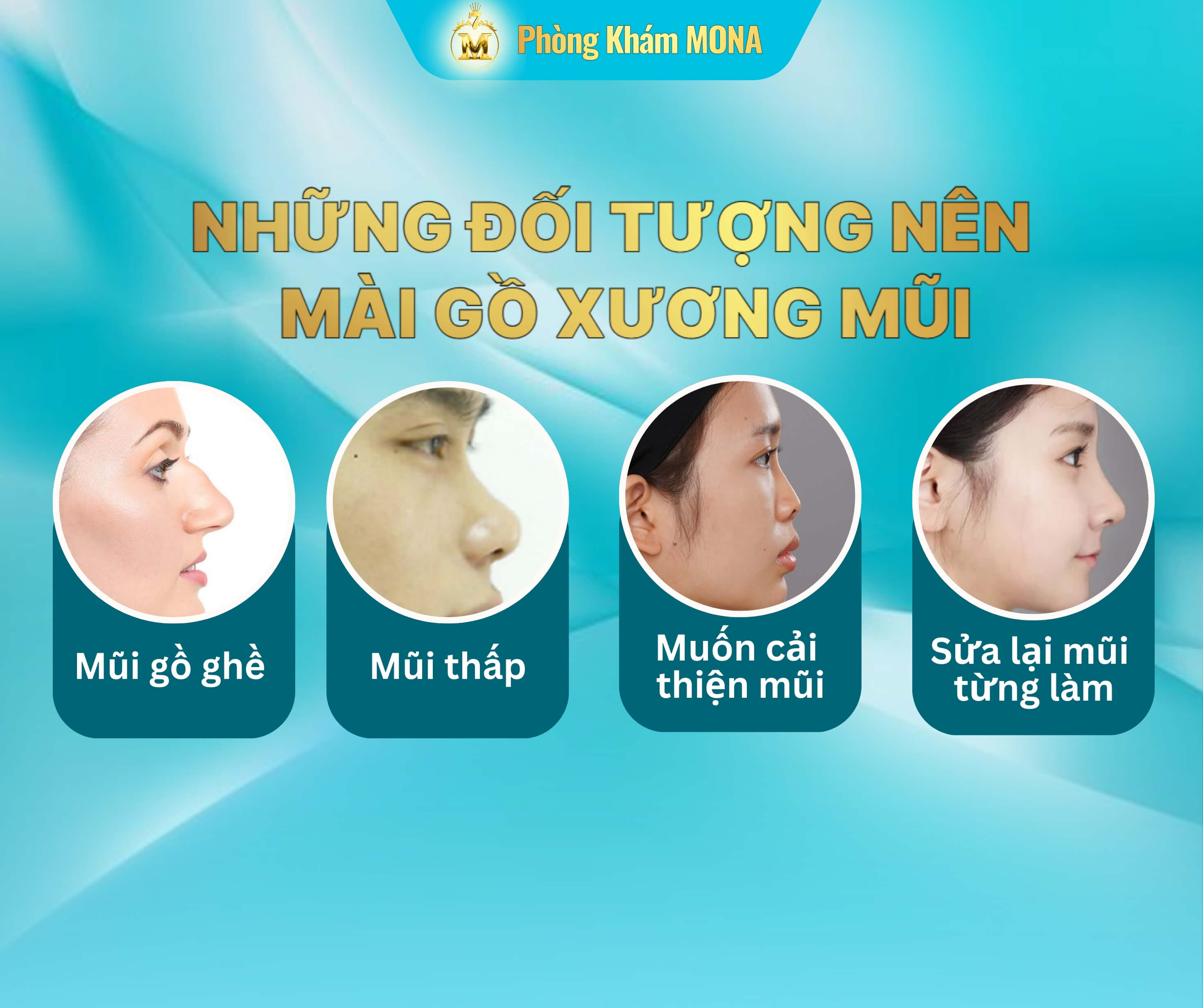 Nhung ai nên mai go xuong mui