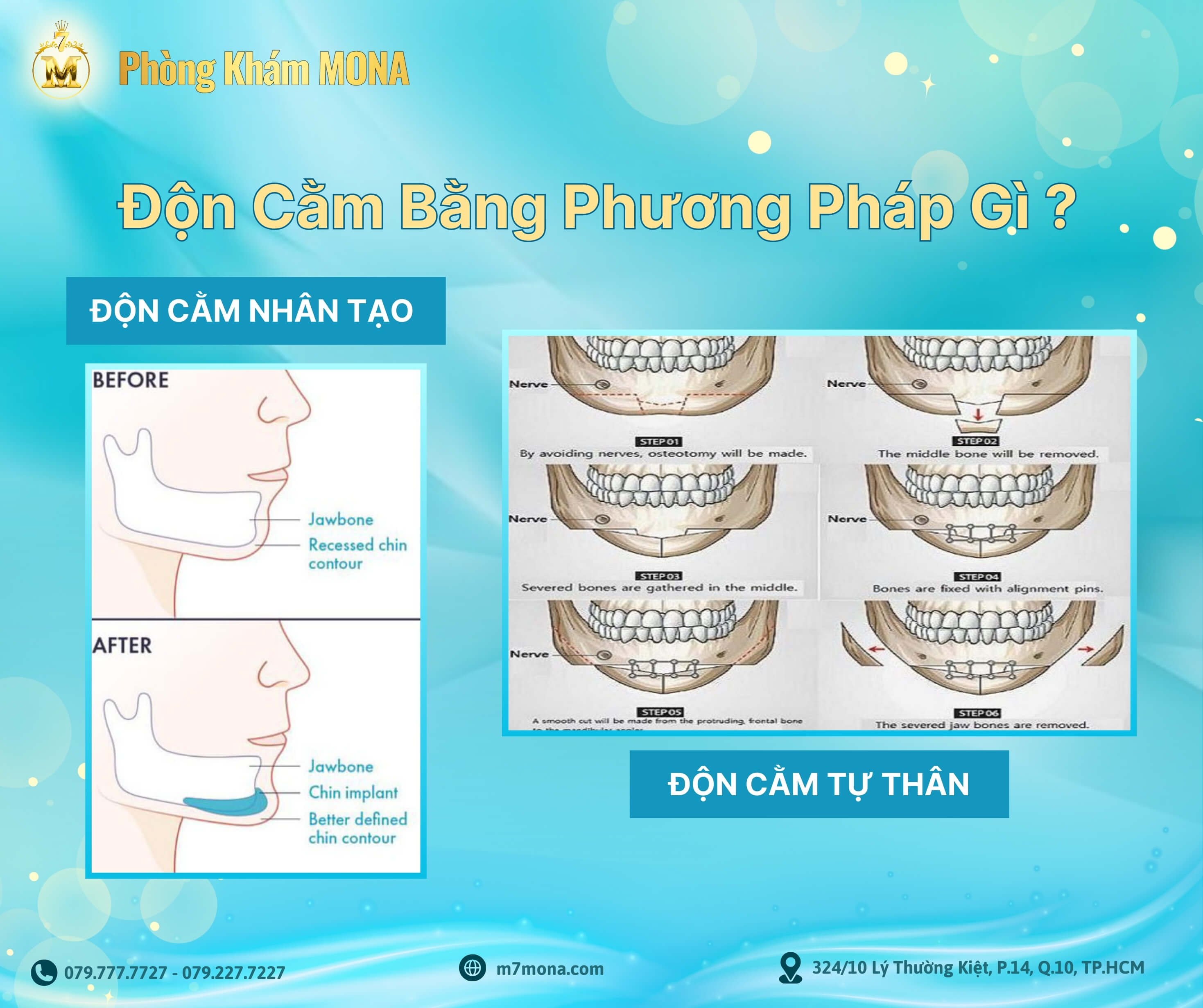 Phuong phap don cam