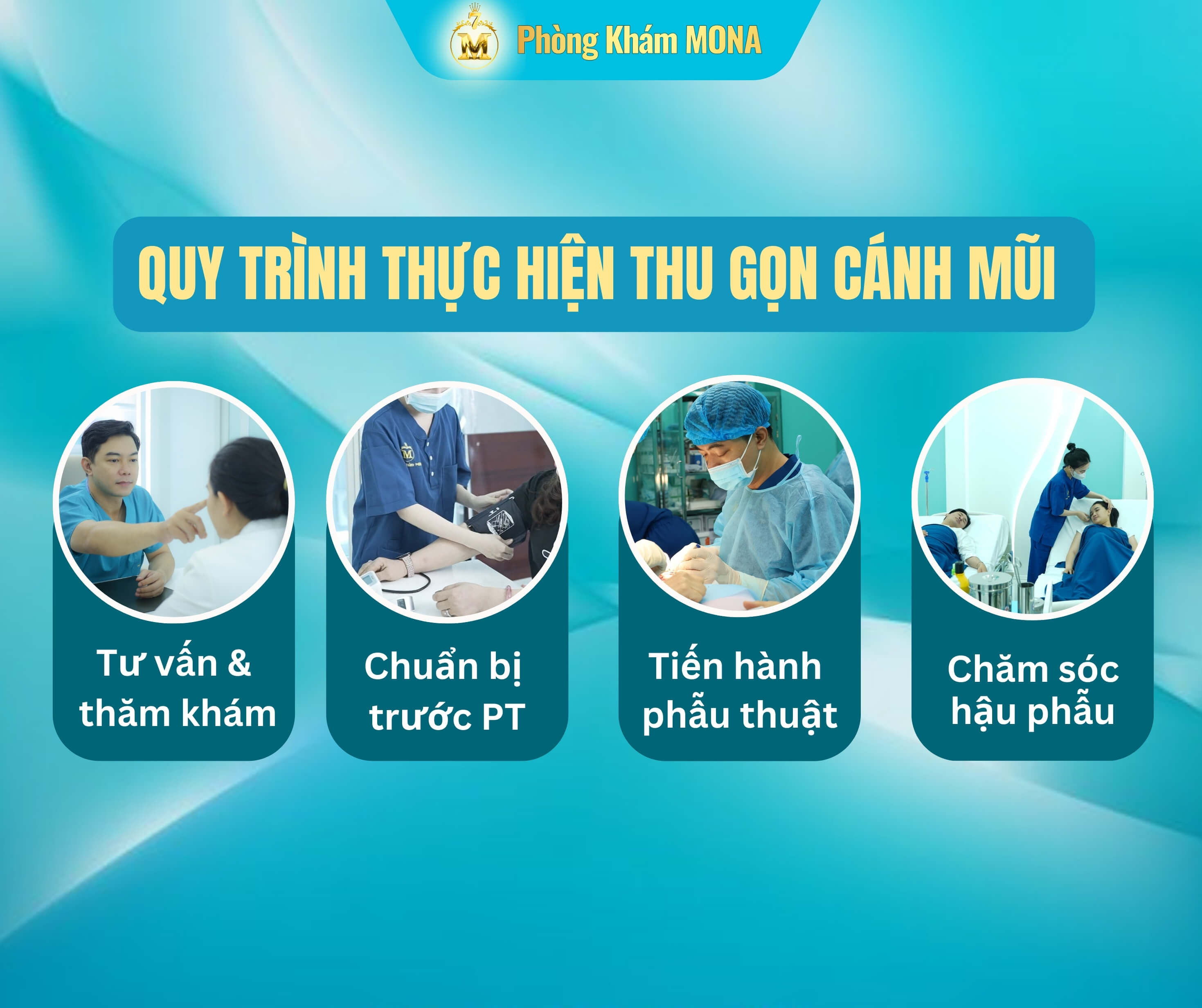 Quy trinh thuc hien thu gon canh mui