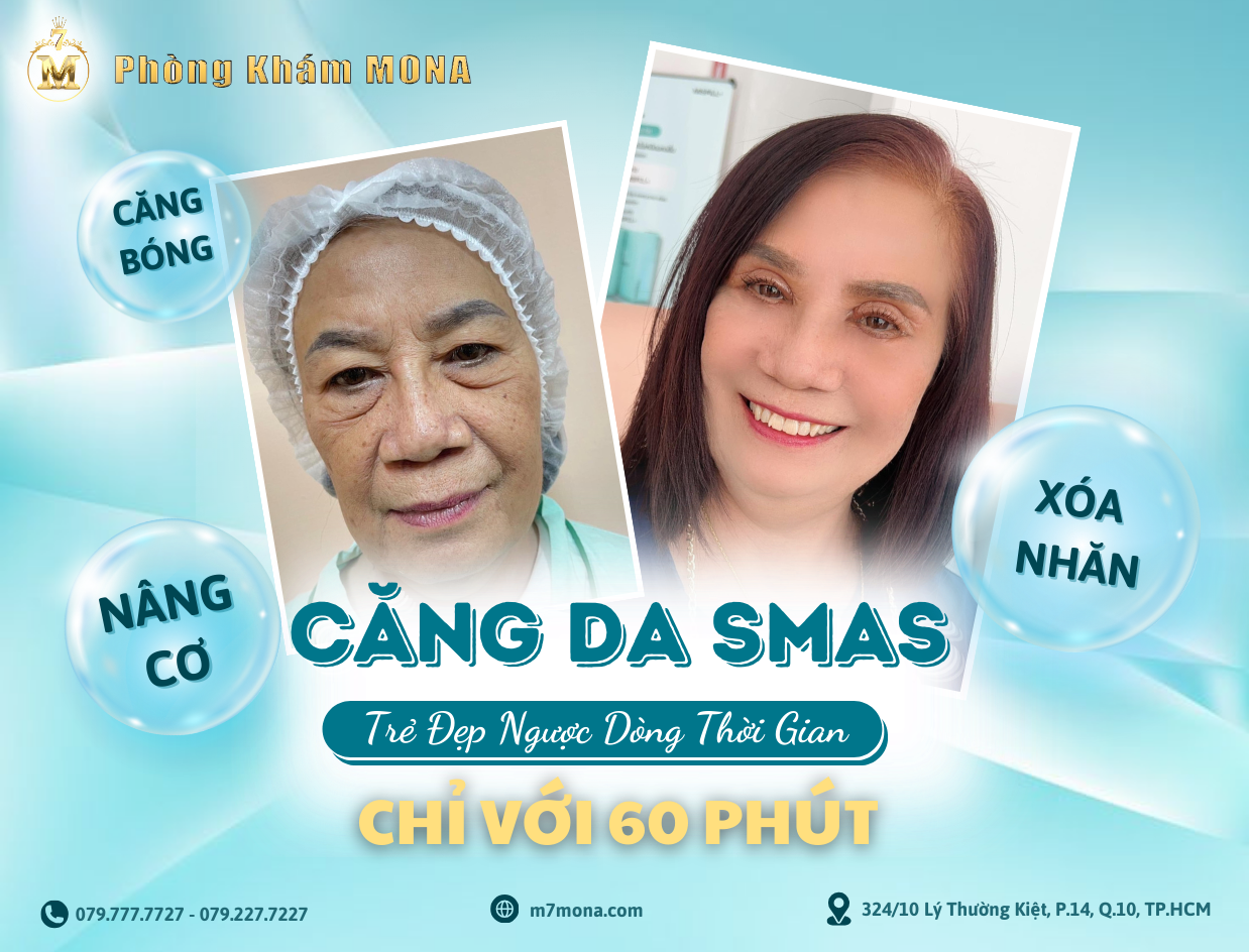 CĂNG DA MẶT SMAS