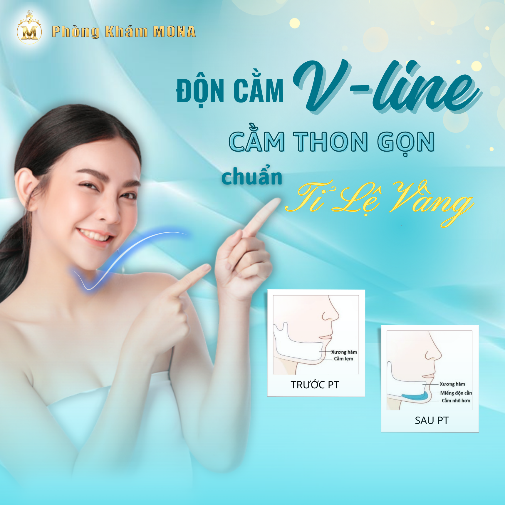 ĐỘN CẰM VLINE