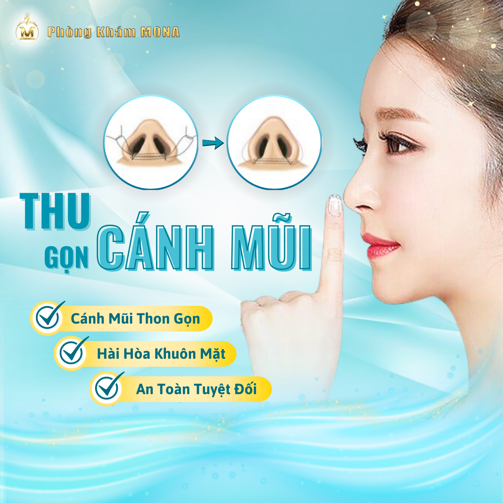 THU GỌN CÁNH MŨI