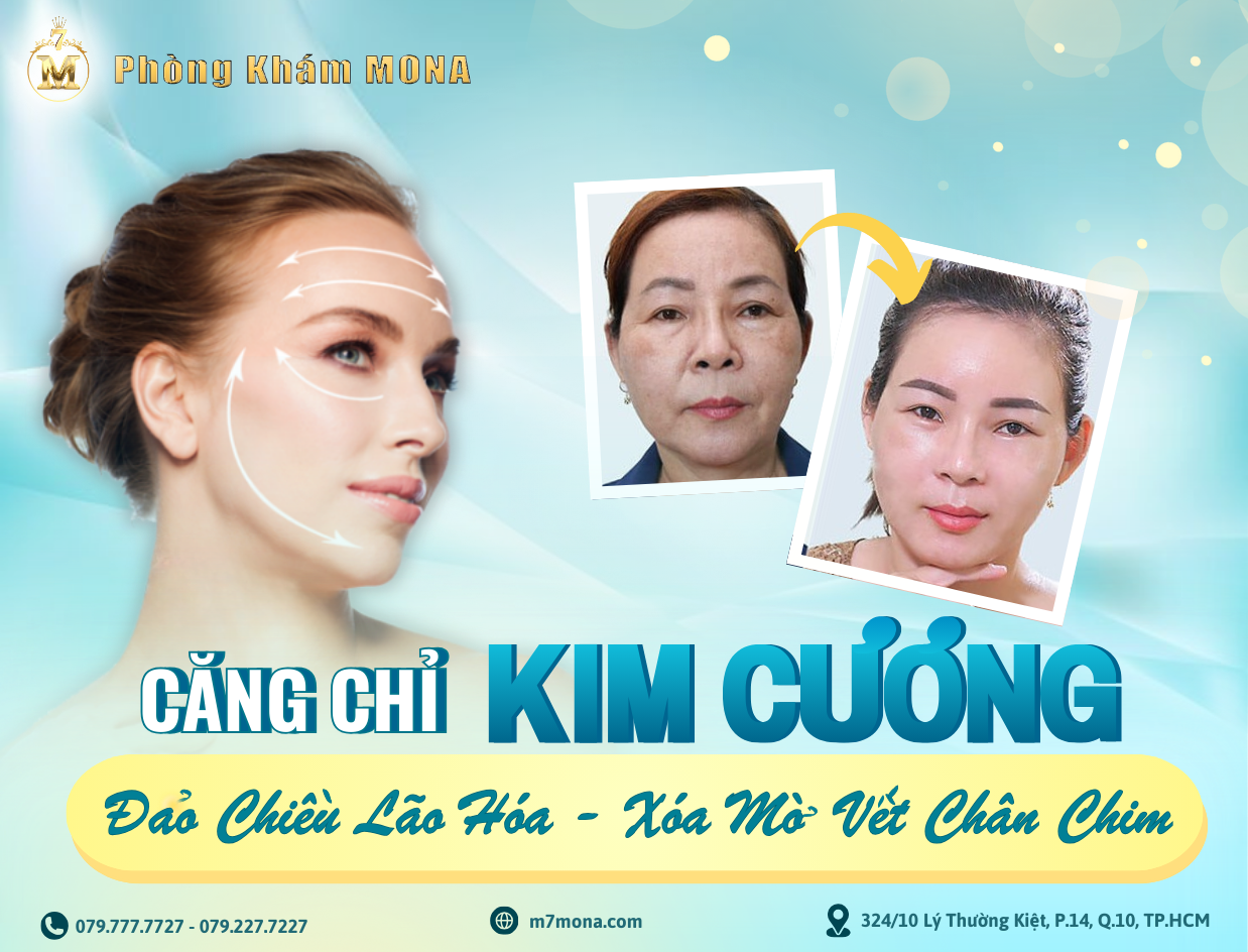 CĂNG CHỈ KIM CƯƠNG