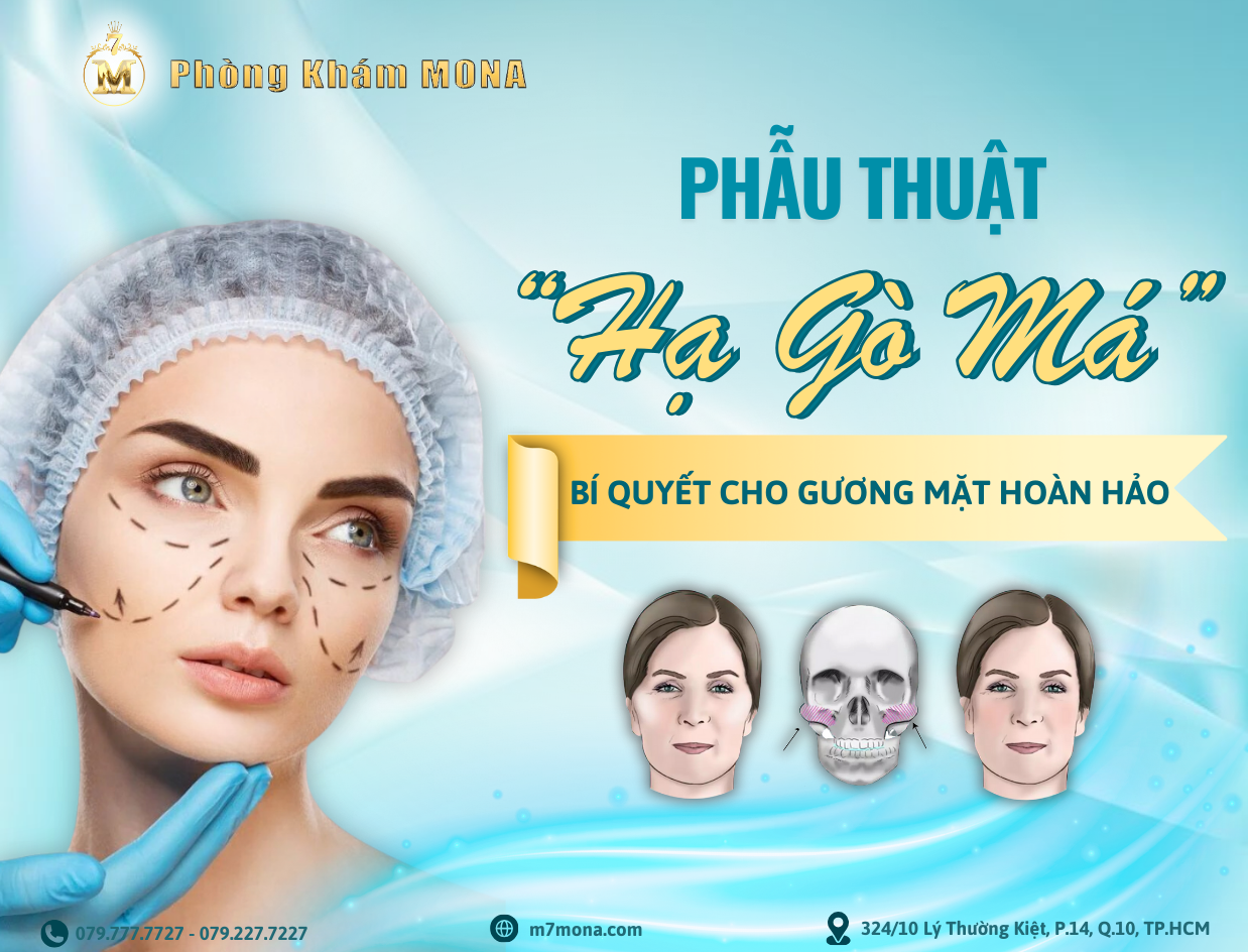 HẠ GÒ MÁ