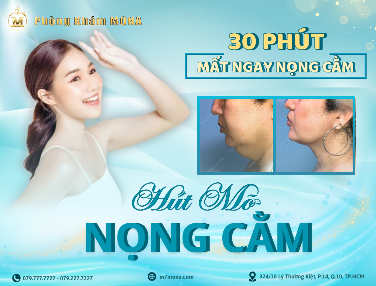 HÚT MỠ NỌNG CẰM