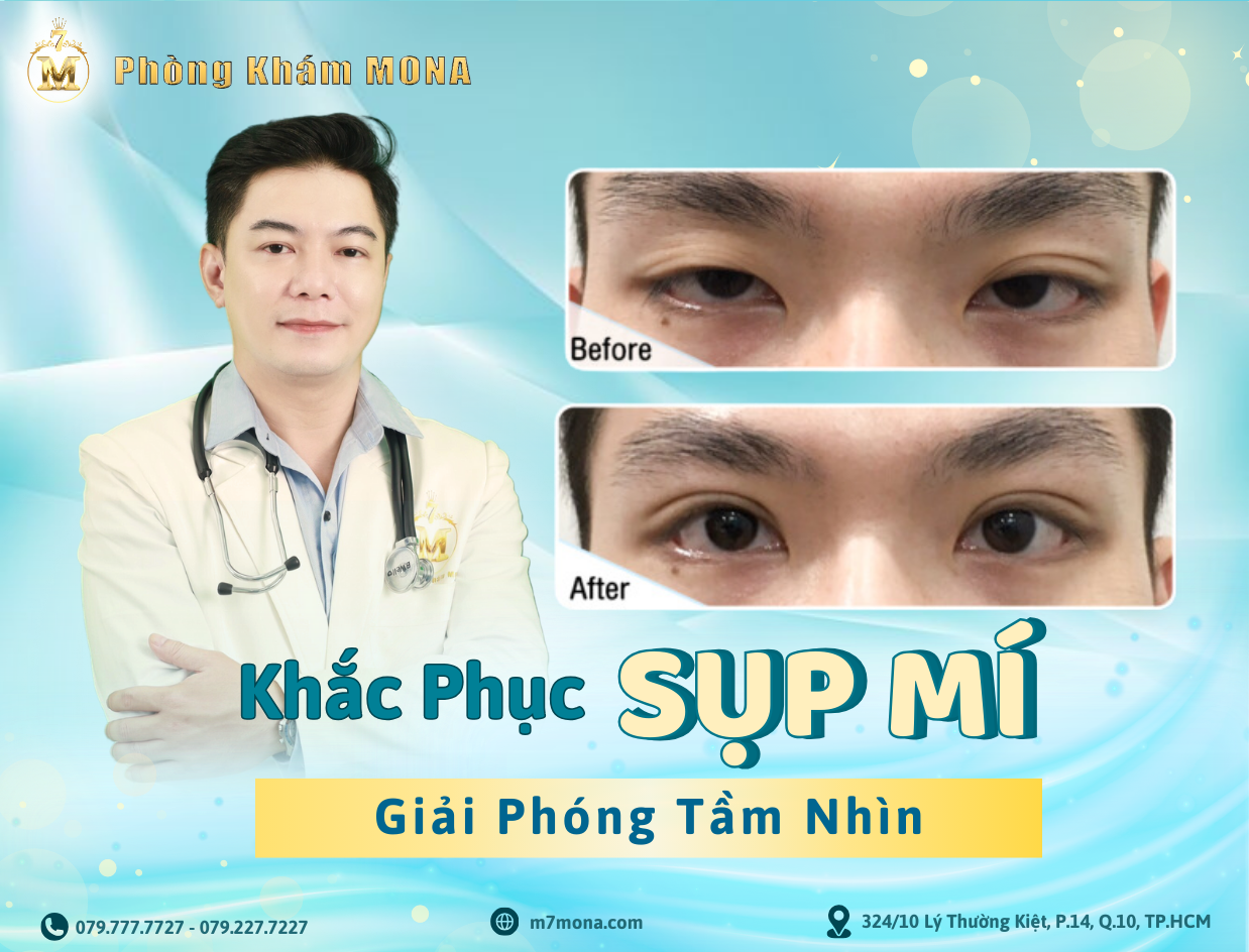 KHẮC PHỤC SỤP MÍ