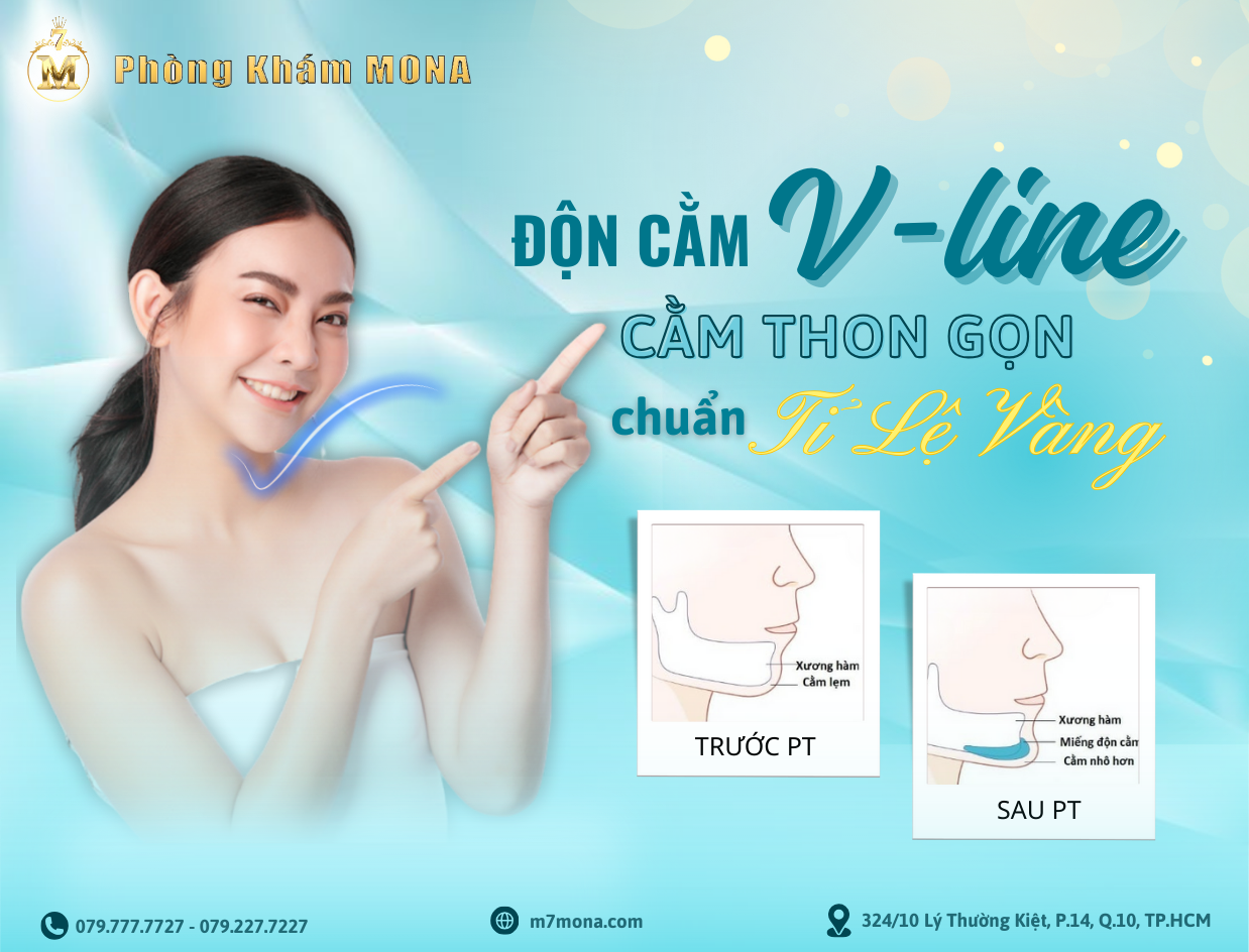 ĐỘN CẰM VLINE