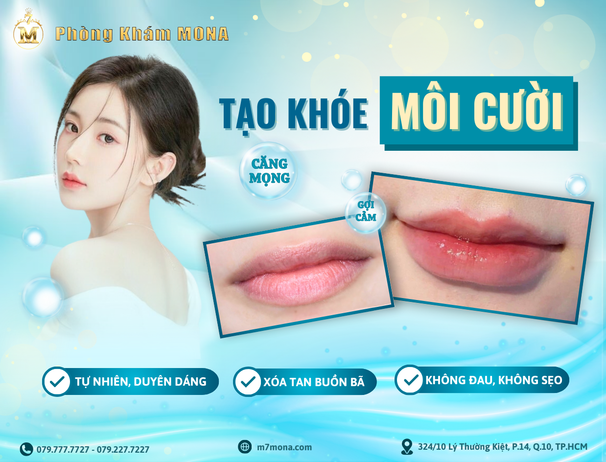 TẠO KHOÉ MÔI CƯỜI